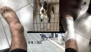 Salihli'de pitbull saldırısı iki polis yaralandı