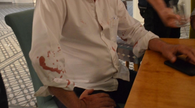 Didim'in CHP'li belediye başkanına saldırı