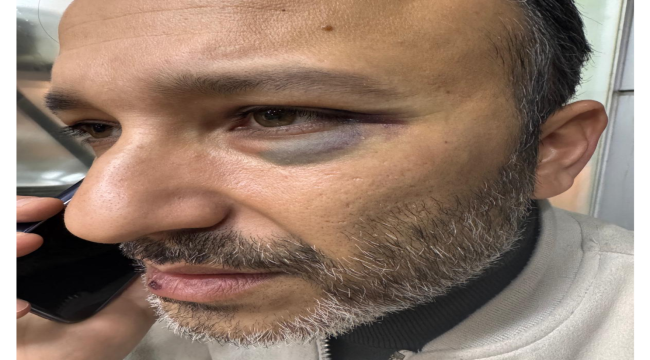 Salihli'de CHP karıştı! İl ve ilçe yöneticileri bir olup CHP'liye darp etti